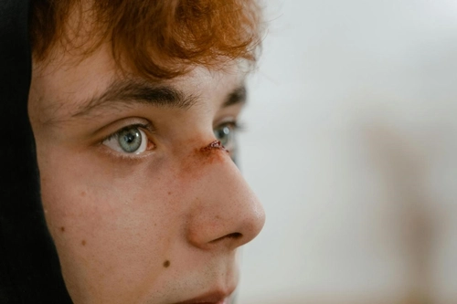 Young man with a fresh cut on his nose